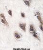 Growth Factor Receptor Bound Protein 2 (GRB2) Antibody