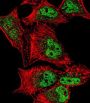 Myocyte-Specific Enhancer Factor 2C (MEF2C) Antibody