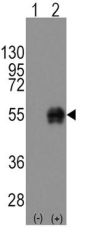Cluster Of Differentiation 14 (CD14) Antibody