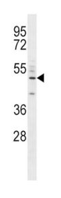 Cluster Of Differentiation 14 (CD14) Antibody