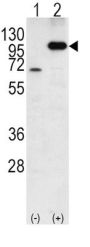 Amyloid-beta Precursor Protein (APP) Antibody