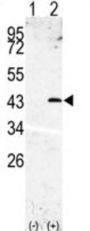 SPPL3 Antibody