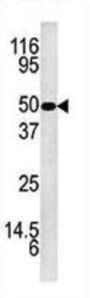 Kallikrein 5 Antibody