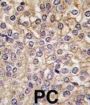 Interleukin-1 Receptor Type 1 (IL1R) Antibody