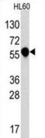 Interleukin-1 Receptor Type 1 (IL1R) Antibody