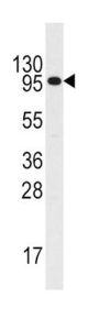 IL3R Antibody
