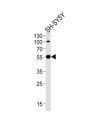 E3 Ubiquitin-Protein Ligase Parkin (PRKN) Antibody