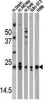 Protein DJ-1 (DJ-1) Antibody