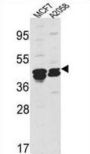 Actin-Related Protein 2 (ACTR2) Antibody