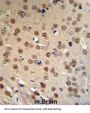 APC Membrane Recruitment Protein 1 (AMER1) Antibody