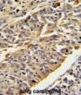 CTSE Antibody