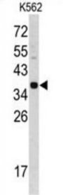 CTSE Antibody