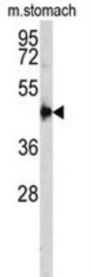 CTSE Antibody