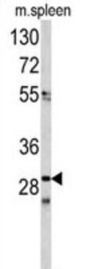 CDCA3 Antibody