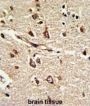 PDIA6 Antibody