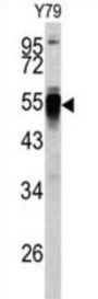 PDIA6 Antibody