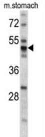 PDIA6 Antibody