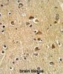 Protein Disulfide Isomerase A6 (PDIA6) Antibody