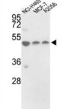 Protein Disulfide Isomerase A6 (PDIA6) Antibody