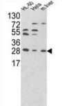 PSME2 Antibody