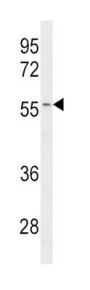 Cytochrome P450 2C19 (CYP2C19) Antibody