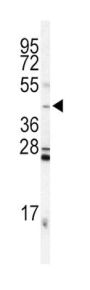 Inhibin Alpha (INHA) Antibody
