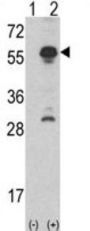 Inhibin Alpha (INHA) Antibody