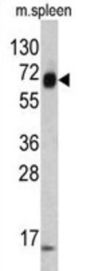 Keratin, Type II Cytoskeletal 4 (KRT4) Antibody