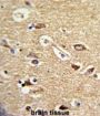 Translocase of Outer Mitochondrial Membrane 70A (TOMM70A) Antibody