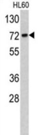 Translocase of Outer Mitochondrial Membrane 70A (TOMM70A) Antibody