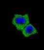 Mothers Against Decapentaplegic Homolog 7 (Smad7) Antibody