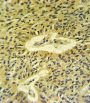 Mothers Against Decapentaplegic Homolog 7 (Smad7) Antibody