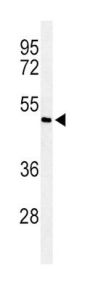 Mothers Against Decapentaplegic Homolog 7 (Smad7) Antibody