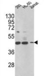 3-Keto-Steroid Reductase (HSD17B7) Antibody