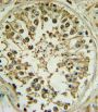 Proto-Oncogene Wnt-1 (WNT1) Antibody