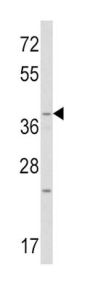 Proto-Oncogene Wnt-1 (WNT1) Antibody