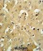Corticotropin Releasing Hormone Receptor 2 (CRHR2) Antibody