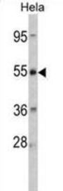 Corticotropin Releasing Hormone Receptor 2 (CRHR2) Antibody