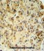 FUCA1 Antibody