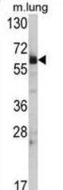 Heat Shock Protein HSP60 (Hsp 60) Antibody