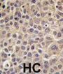 Myotubularin Related Protein 8 (MTMR8) Antibody