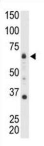Myotubularin Related Protein 8 (MTMR8) Antibody