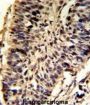 Small Nuclear Ribonucleoprotein D2 Polypeptide (SNRPD2) Antibody
