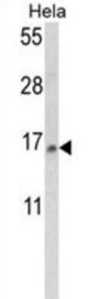 Small Nuclear Ribonucleoprotein D2 Polypeptide (SNRPD2) Antibody