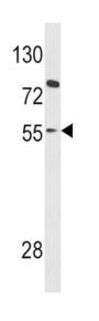 Paired Box Protein Pax-8 (PAX8) Antibody