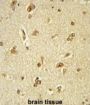 General Transcription Factor III (GTF2I) Antibody