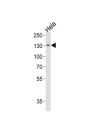 General Transcription Factor III (GTF2I) Antibody