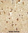 DLX2 Antibody