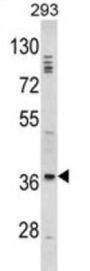 DLX2 Antibody