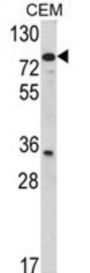 Transglutaminase 4, Prostate (TGM4) Antibody